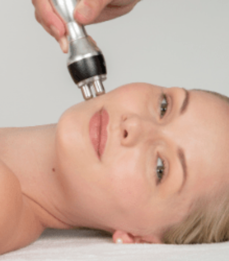 radio frequency facial