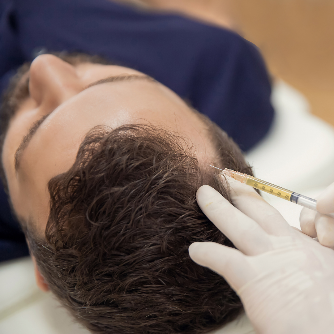 PRP Hair Restoration Course