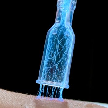 plasma infusion